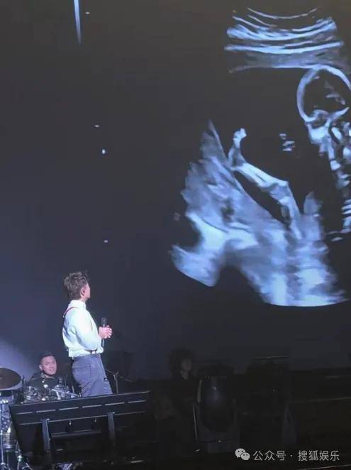调侃“接受不了生女儿”被骂好几天<strong></p>
<p>BTC交易APP下载</strong>，他自曝差点因此家庭破裂......