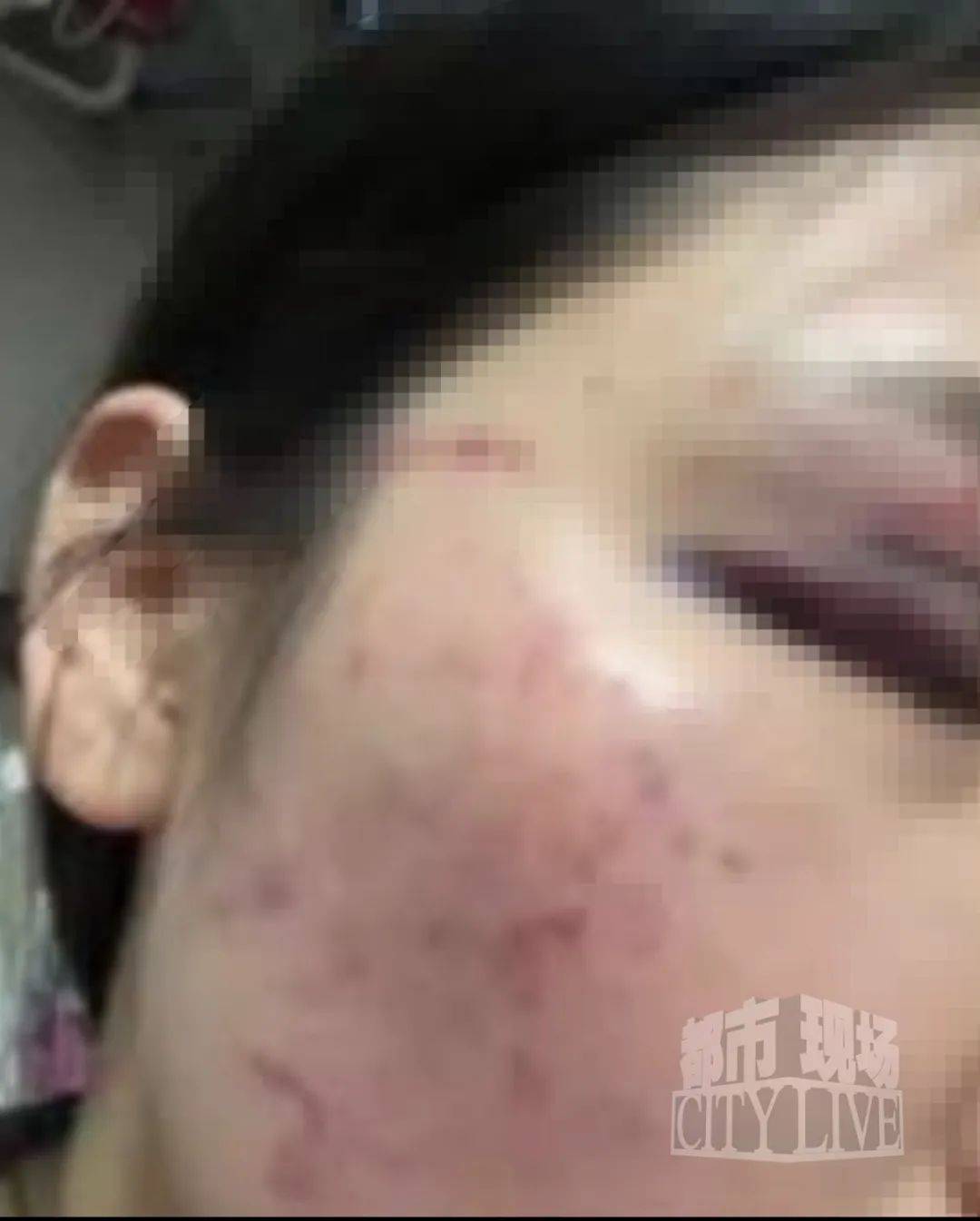 湖南衡阳29岁女子疑被男友施暴后从25楼跳下身亡 男友徐某此前还刺激说：“你放心<strong></p>
<p>ETH交易APP下载</strong>，她不会去死的”